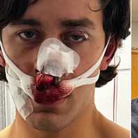 Heroic NY Paramedic, Model Stabbed While Saving Women From Attackers In Germany