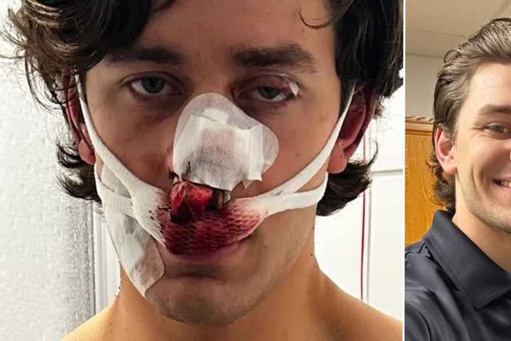 Heroic NY Paramedic, Model Stabbed While Saving Women From Attackers In Germany