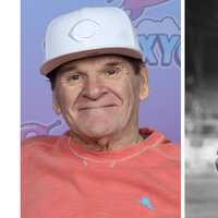 MLB Lifts Bans On All-Time Hits Leader Pete Rose, 'Shoeless' Joe Jackson