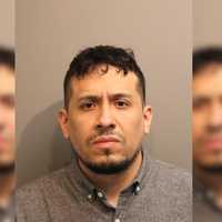 Driver Hit Norwalk Child Riding His Bike, Sending Him To Hospital With Serious Injuries: Police