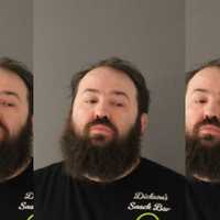 CT Man Charged With Animal Cruelty After Dogs Found With Infections, Wounds, Sicknesses