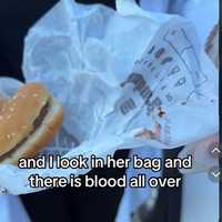 <p>Tiffany Floyd shows her daughter's Burger King meal covered in blood.</p>