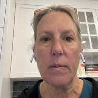 <p>Mohan snaps a selfie during early stages of jaundice.</p>