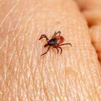 First Human Case Of Tick-Borne Illness Spotted In Connecticut