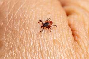 First Human Case Of Tick-Borne Illness Spotted In Connecticut