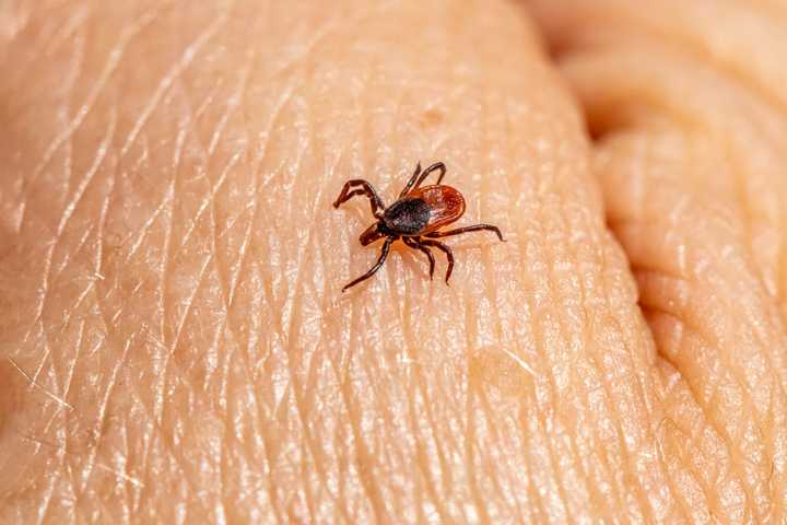 First Human Case Of Tick-Borne Illness Spotted In Connecticut