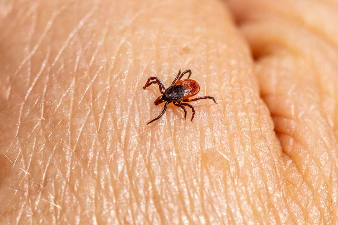 First Human Case Of Tick-Borne Illness Spotted In Connecticut | Lyme ...