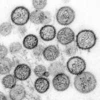 American Dies From Hantavirus In Case Not Linked To Cruise Ship Outbreak
