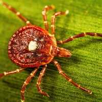 Tick Bites Can Spark Dangerous Alpha-Gal Syndrome