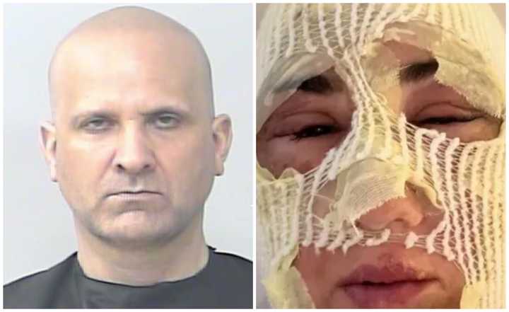 49-year-old William DiBernardino Jr. of Boynton Beach, FL, was accused of hiring two people to carry out an acid attack on his ex-fiancé in Monroe Township, Gloucester County, NJ.
  
