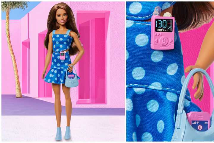 Mattel Releases First Barbie Doll With Diabetes To Inspire Kids With Condition