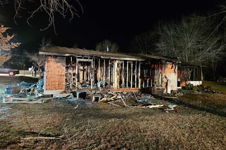 Homeowner Hospitalized As Fire Causes $280K In Damages In Maryland: Officials